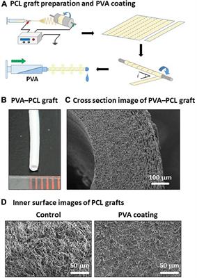 Polyvinyl alcohol coating prevents platelet adsorption and improves mechanical property of polycaprolactone-based small-caliber vascular graft